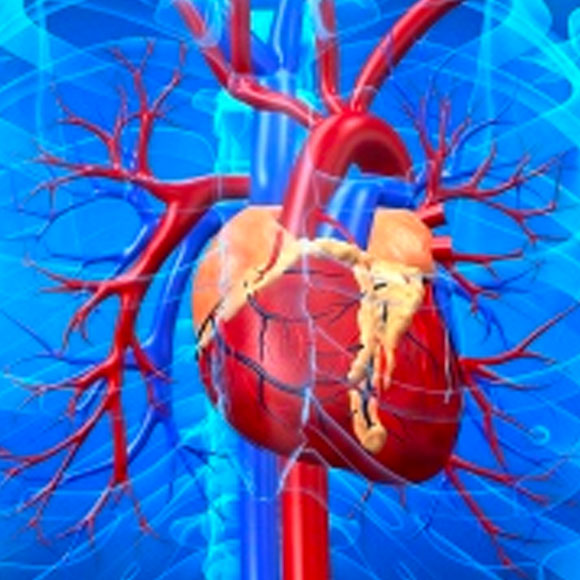 Por primera vez implantan un cardiodesfibrilador subcutáneo en un adolescente