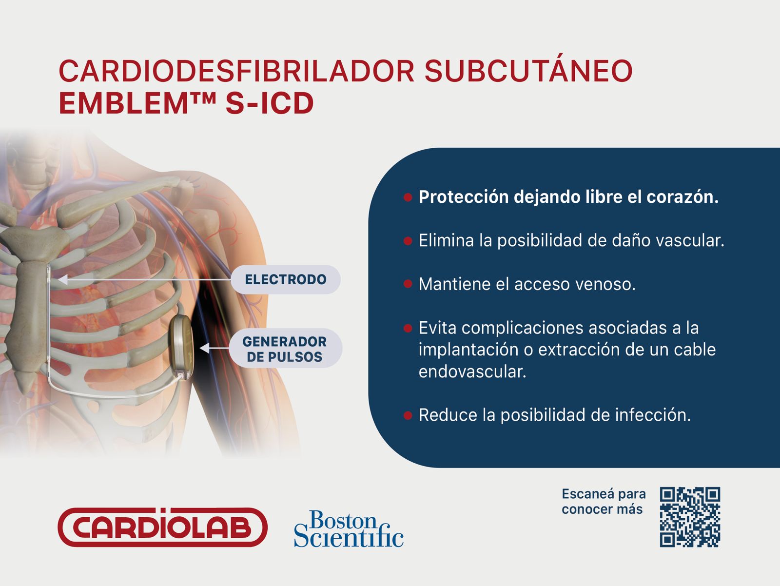 Cardiodesfibrilador Subcutáneo EMBLEM™ S-ICD