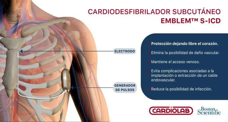 Se realizó el primer implante de un cardiodesfibrilador subcutáneo EMBLEM S ICD en Santiago del Estero
